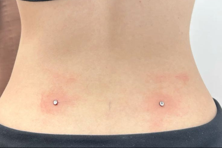 Dermal Piercing