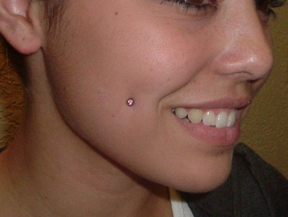 Dermal/ Cheek Piercing